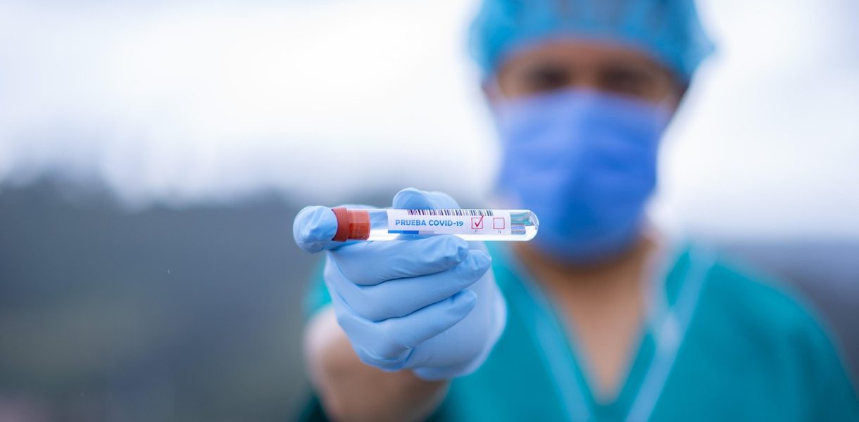 how much is rental car insurance in italy